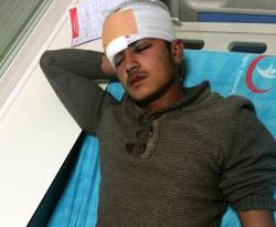 مصرع سوري وإصابة آخر جراء انفجار لغم على الحدود مع تركيا