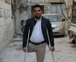 رغم بتر قدمه.. نازح من تدمر، يتحول إلى أشهر مصلح للكهربائيات في الباب