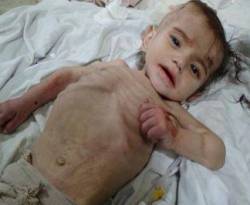 صور مُروّعة لأطفال تموت جوعاً في مخيم اليرموك وكيلو الرز بـ 6 آلاف ليرة