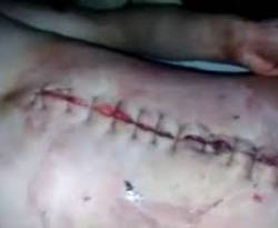 يعلنون وفاة الجندي قبل موته الفعلي...خلية طبية يقودها أحد أفراد 