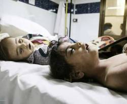 اتهامات لنظام الأسد بدسّ مادة سامة.. الملح يتسبب بكارثة في الغوطة