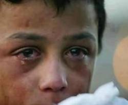 الصحة العالمية: الاشتباه بإصابة 22 بشلل الأطفال في سوريا