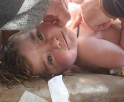 معلومة تخص مصابي الكيماوي في خان شيخون، ربما لن تصدقها