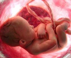 تكلفة العملية القيصرية بـ 250 ألف ليرة و10 آلاف حالة إجهاض العام الماضي