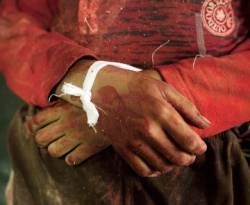 85 % من مشافي البلاد بين مدمر ومقفل... صحة سوريا في غيبوبة مريعة