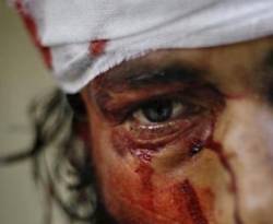 الدواء السوري يرتفع 30% ةالنظام يتاجر بـ